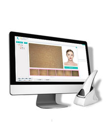 Tragbare Gesichtshaut-Bereich-Analysator-Diagnosen-System-Schönheits-Haut-Bereich-Maschine